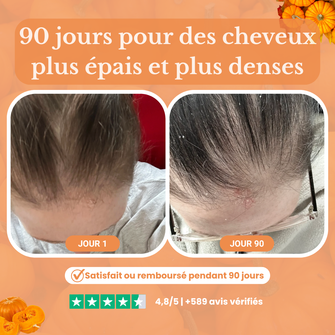 Gélules d’huile de graines de courge